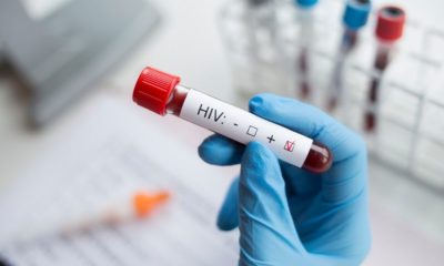 HIV test | CDC: More Than 150K People Infected with HIV Don't Know They Have it | Featured