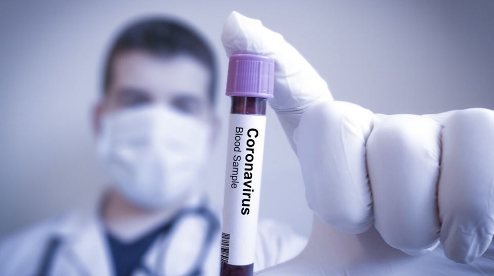 Doctor holding nCoV b;ppd sample | New Studies Reveal How Long Coronavirus Stays on Contaminated Surfaces | Featured