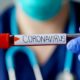 Nurse holding a blood test result of corona virus patient | Coronavirus Poses Threat to U.S. Economy | Featured
