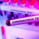 Coronavirus Blood Test | U.S. Announces New Measures to Speed Coronavirus Testing | Featured