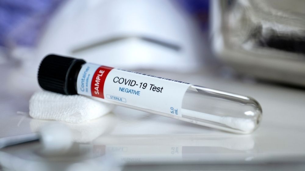 Tube Containing a Swab Sample for COVID-19 | Ohio Gov. Mike DeWine Tests Negative for COVID-19 on His Second Test | Featured