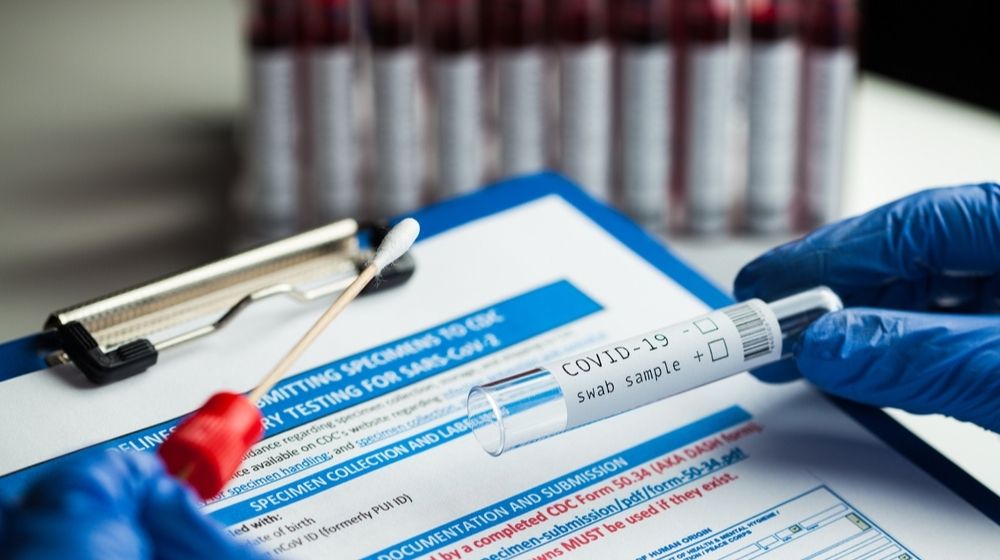 Lab Scientist Folding COVID-19 Test Kit | CDC Keeps New Testing Guidelines Despite State Backlash | Featured