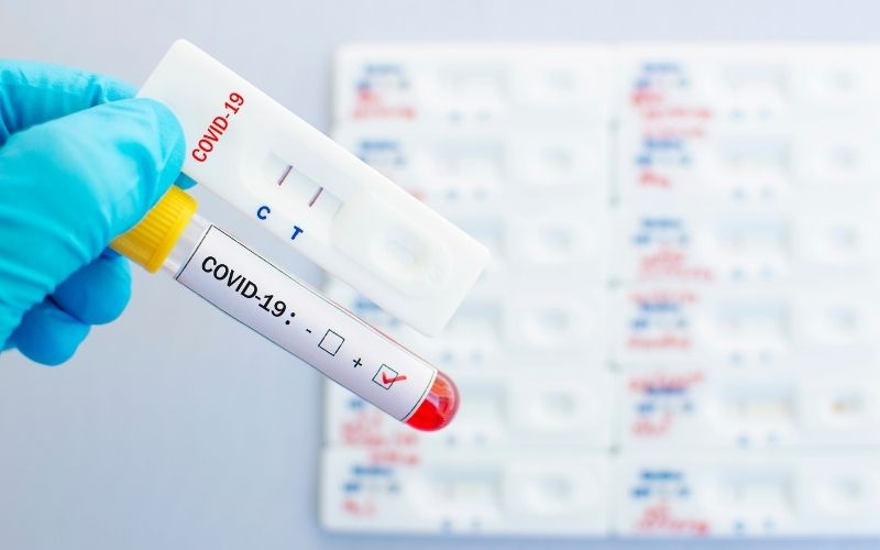 Cassette Rapid Test for Covid-19 | Kroger Health to Offer Rapid Coronavirus Antibody Testing at All Pharmacy and Clinic Locations by Next Month