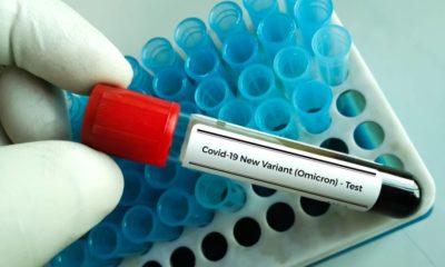 Researcher hold blood sample for New Variant of the Covid-19 Omicron B.1.1.529 test | First COVID Omicron Case Detected In the United States | featured