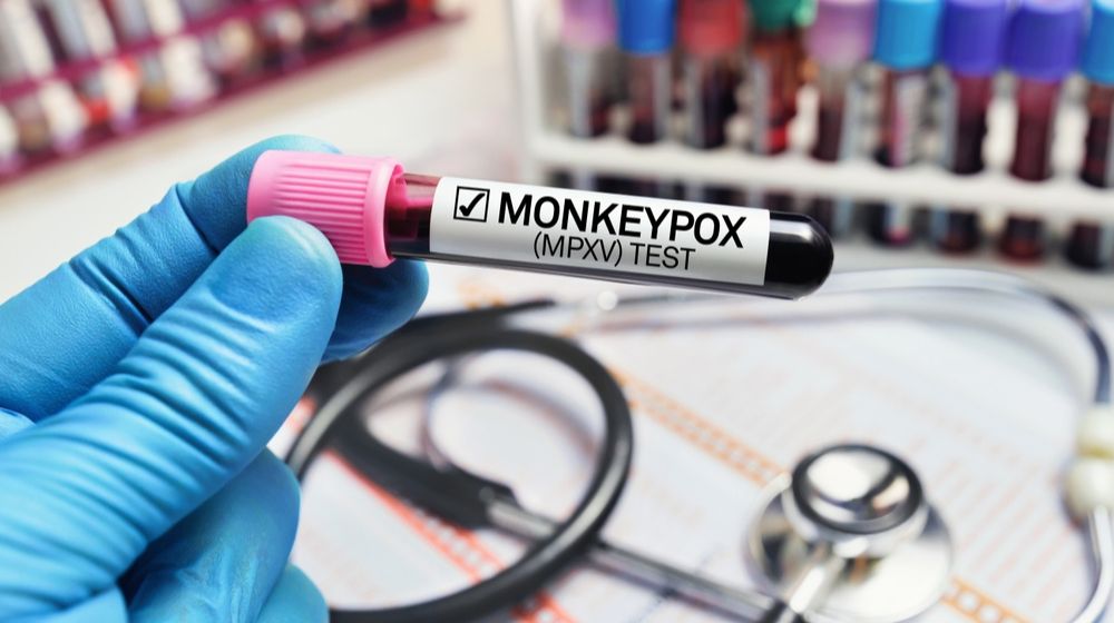 Biden Admin Set to Declare Monkeypox a Public Health Emergency-ss-Featured