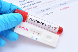 A person holding a sample and a positive test result for COVID-19-Georgia Secretary of State Brad Raffensperger to Quarantine as Wife Tests Positive for COVID-19-ss-featured