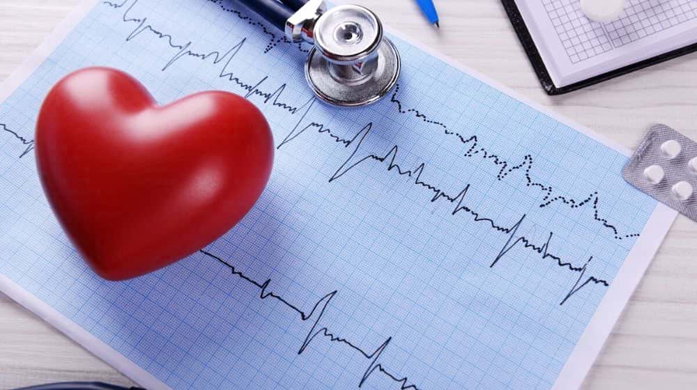 cardiogram result with stethoscope | CVS Minute Clinic Offers Free Heart Health Screenings [PRINTABLE VOUCHER] | Featured
