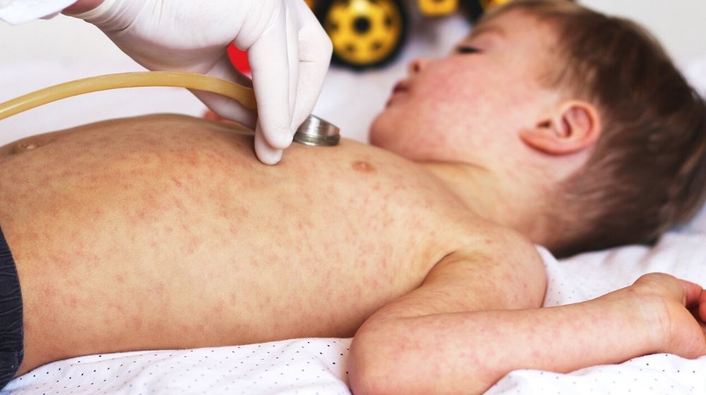 Child having a check-up | Measles Threat Set to Climb During the Holidays | Featured