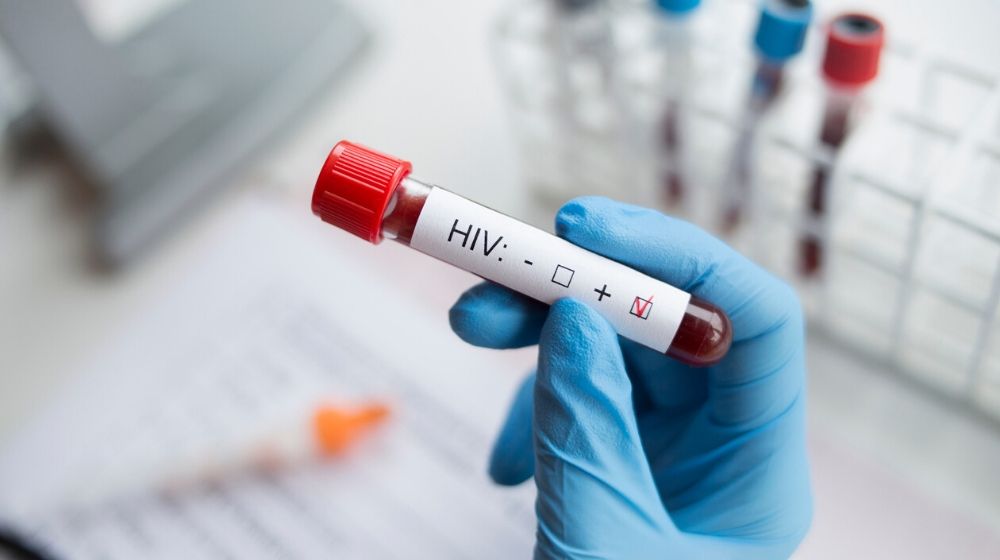 HIV test | CDC: More Than 150K People Infected with HIV Don't Know They Have it | Featured