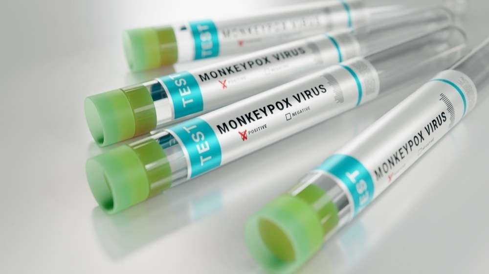 Monkeypox Case Reported Within Boston Public School Community-ss-Featured
