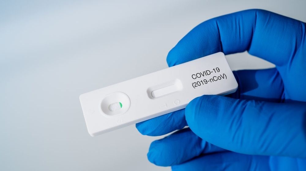 Test Kit for Viral Disease COVID-19 | Costco Sells COVID-19 Saliva PCR Test Kits | Featured