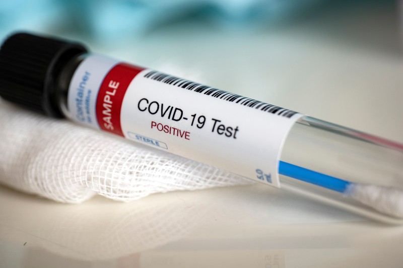 Testing for presence of coronavirus. Tube containing a swab sample that has tested positive for COVID-19 | Democrats Tested Positive