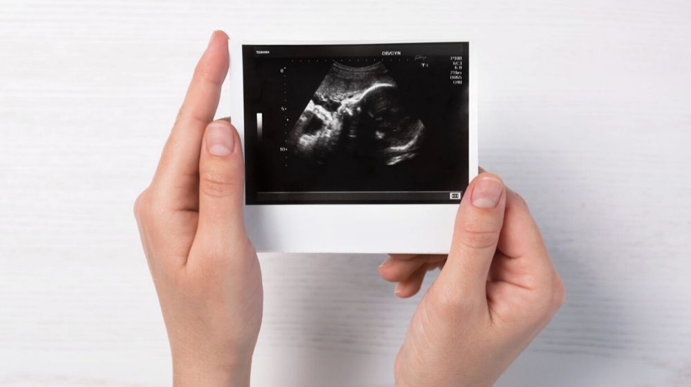 Georgia Supreme Court Restores State Heartbeat Bill